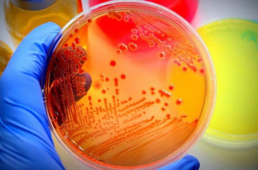 agar de cultivo